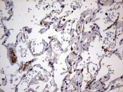 Immunohistochemistry: VSIG3/IGSF11 Antibody (OTI2H1) [NBP2-46046] - Analysis of Human lung tissue.