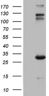 Western Blot: VSIG3/IGSF11 Antibody (OTI2H1) [NBP2-46046] - Analysis of HEK293T cells were transfected with the pCMV6-ENTRY control (Left lane) or pCMV6-ENTRY IGSF11 .