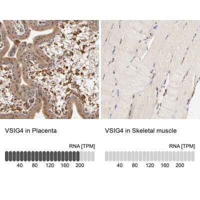 Immunohistochemistry-Paraffin: VSIG4 Antibody [NBP1-86843] - Staining in human placenta and skeletal muscle tissues.. Corresponding VSIG4 RNA-seq data are presented for the same tissues.