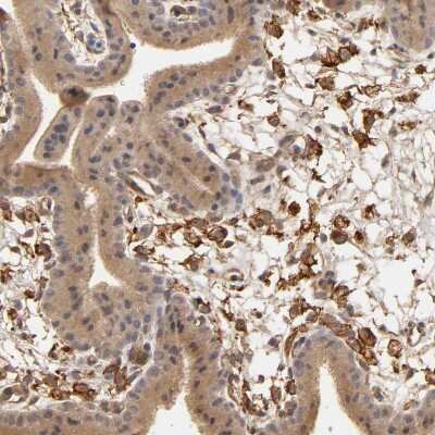 Immunohistochemistry-Paraffin: VSIG4 Antibody [NBP1-86843] - Staining of human placenta shows moderate to strong positivity in Hofbauer cells.