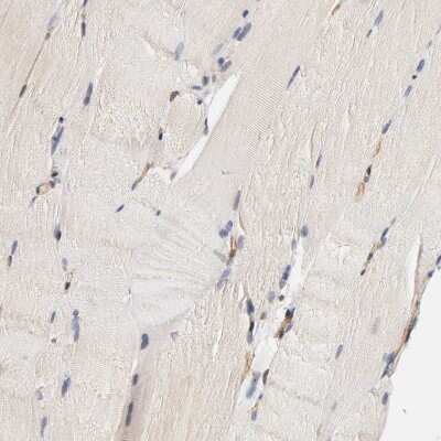 Immunohistochemistry-Paraffin: VSIG4 Antibody [NBP1-86843] - Staining of human skeletal muscle shows no positivity in myocytes as expected.