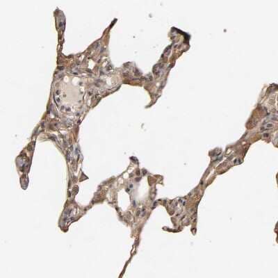 <b>Orthogonal Strategies Validation. </b>Immunohistochemistry-Paraffin: VSIG4 Antibody [NBP1-86843] - Staining of human lung shows moderate to strong cytoplasmic positivity in macrophages.