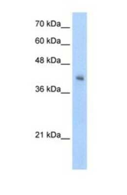 Western Blot: VSIG4 Antibody [NBP1-69631] - This Anti-VSIG4 antibody was used in Western Blot of Jurkat tissue lysate at a concentration of 5ug/ml.