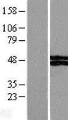 Western Blot: VSIG4 Overexpression Lysate (Adult Normal) [NBL1-17763] Left-Empty vector transfected control cell lysate (HEK293 cell lysate); Right -Over-expression Lysate for VSIG4.