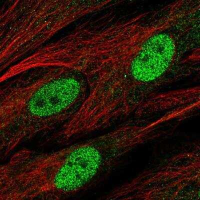 Immunocytochemistry/Immunofluorescence: VSIG8 Antibody [NBP2-76544] - Staining of human cell line BJ shows localization to nucleoplasm. Antibody staining is shown in green.
