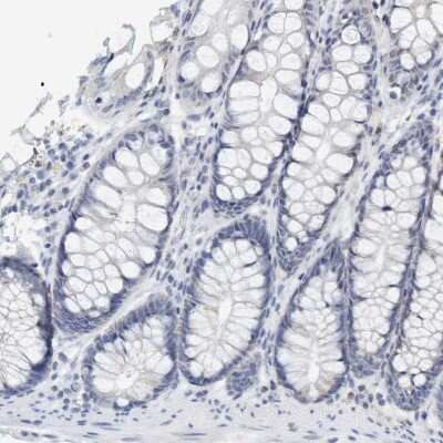 Immunohistochemistry-Paraffin VSIG8 Antibody - BSA Free