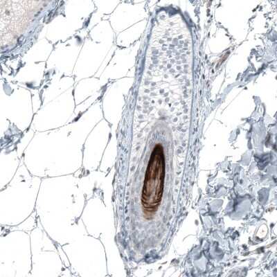 Immunohistochemistry-Paraffin VSIG8 Antibody - BSA Free
