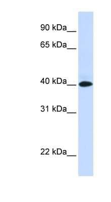 Western Blot: VSIG8 Antibody [NBP1-70742] - Human Muscle lysate, concentration 0.2-1 ug/ml.