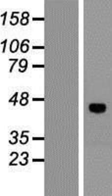 Western Blot VSIG8 Overexpression Lysate