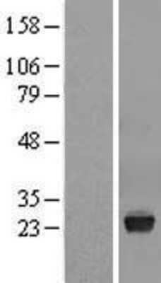 Western Blot: VSTM2L Overexpression Lysate (Adult Normal) [NBL1-17766] Left-Empty vector transfected control cell lysate (HEK293 cell lysate); Right -Over-expression Lysate for VSTM2L.