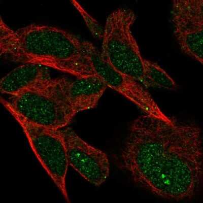 Immunocytochemistry/Immunofluorescence: VSTM4 Antibody [NBP1-94127] - Staining of human cell line SH-SY5Y shows localization to nucleus & vesicles. Antibody staining is shown in green.
