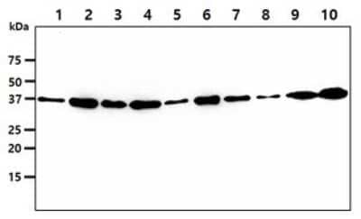 Western Blot: VTA1 Antibody (14G10) [NBP2-59420] - Lane 1: HepG2 cell lysate, Lane 2: 293T cell lysate, Lane 3: HeLa cell lysate, Lane 4: MCF7 cell lysate, Lane 5: A549 cell lysate, Lane 6: Jurkat cell lysate, Lane 7: K562 cell lysate, Lane 8: LnCaP cell lysate, Lane 9: U937 cell lysate, Lane 10: A431 cel