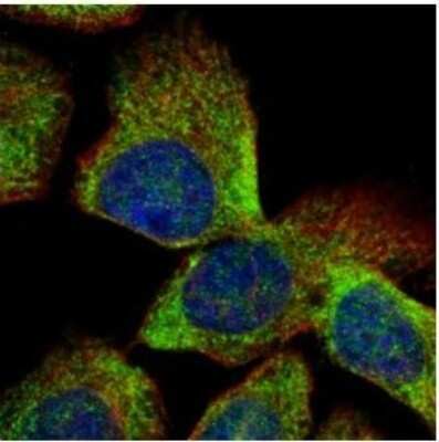 Immunocytochemistry/Immunofluorescence: VTA1 Antibody [NBP1-32570] - Analysis of methanol-fixed A431, using VTA1 antibody (Green) at 1:500 dilution. Alpha-tubulin filaments were labeled with an alpha Tubulin antibody (Red) at 1:500.