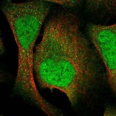 <b>Independent Antibodies Validation. </b>Immunocytochemistry/Immunofluorescence: VTA1 Antibody [NBP2-58305] - Staining of human cell line U-2 OS shows localization to nucleoplasm, cytosol & vesicles.