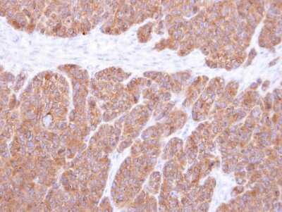 Immunohistochemistry-Paraffin: VTA1 Antibody [NBP1-32570] - Paraffin-embedded SW480 xenograft, using antibody at 1:500 dilution.