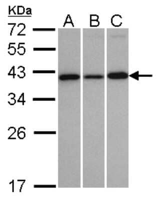 Western Blot: VTA1 Antibody [NBP1-32570] - Sample(30 ug whole cell lysate)A:H1299B:HeLa S3  C:MOLT4  12% SDS PAGE, antibody diluted at 1:1000.