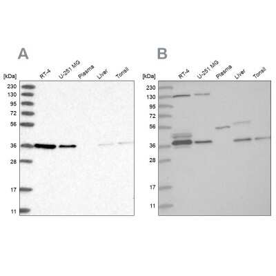 Western Blot: VTA1 Antibody [NBP2-58305] - Analysis using Anti-VTA1 antibody NBP2-58305 (A) shows similar pattern to independent antibody NBP1-86745 (B).