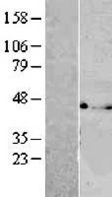 Western Blot: VTA1 Overexpression Lysate (Adult Normal) [NBL1-17767] Left-Empty vector transfected control cell lysate (HEK293 cell lysate); Right -Over-expression Lysate for VTA1.