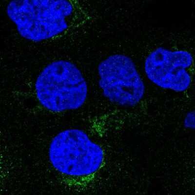 Immunocytochemistry/Immunofluorescence: VTI1A Antibody [NBP2-30952] - Immunofluorescent staining of human cell line A-431 shows localization to the Golgi apparatus & vesicles.