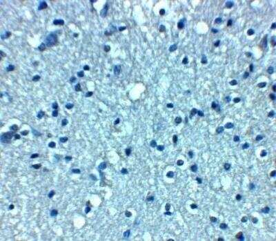 Immunohistochemistry: VTI1A Antibody [NBP2-81876] - Immunohistochemistry of VTI1a in human brain tissue with VTI1a antibody at 5 ug/mL.