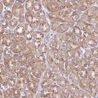 Immunohistochemistry-Paraffin: VTI1A Antibody [NBP2-30952] - Staining of human stomach, lower shows moderate granular cytoplasmic positivity in glandular cells.