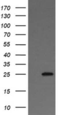 Western Blot: VTI1A Antibody (OTI1F4) - Azide and BSA Free [NBP2-74862] - Analysis of HEK293T cells were transfected with the pCMV6-ENTRY control (Left lane) or pCMV6-ENTRY VTI1A.