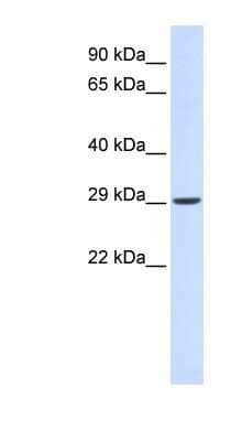 Western Blot: VTI1A Antibody [NBP1-91431] - Human Muscle lysate, concentration 0.2-1 ug/ml.