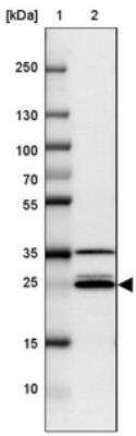 Western Blot: VTI1A Antibody [NBP2-30952] - Lane 1: Marker  [kDa] 250, 130, 100, 70, 55, 35, 25, 15, 10.  Lane 2: CACO-2