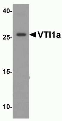 Western Blot: VTI1A Antibody [NBP2-81876] - Western blot analysis of VTI1a in human brain tissue lysate with VTI1a antibody at 1 ug/ml.