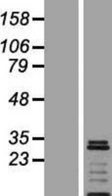 Western Blot: VTI1A Overexpression Lysate (Adult Normal) [NBP2-05485] Left-Empty vector transfected control cell lysate (HEK293 cell lysate); Right -Over-expression Lysate for VTI1A.