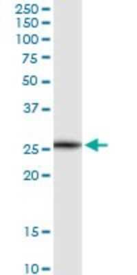 Western Blot: VTI1B Antibody [H00010490-D01P] - Analysis of VTI1B expression in human liver.