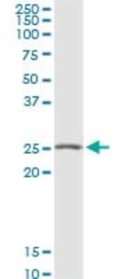 Western Blot: VTI1B Antibody [H00010490-D01P] - Analysis of VTI1B expression in mouse kidney.
