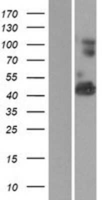 Western Blot: VWA1 Overexpression Lysate (Adult Normal) [NBP2-06399] Left-Empty vector transfected control cell lysate (HEK293 cell lysate); Right -Over-expression Lysate for VWA1.