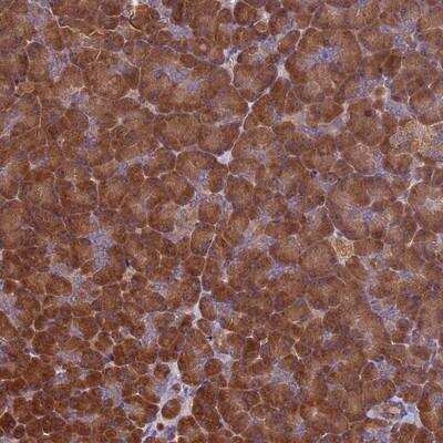 Immunohistochemistry: VWA3A Antibody [NBP1-93775] - Staining of human pancreas shows strong cytoplasmic positivity in exocrine glandular cells.