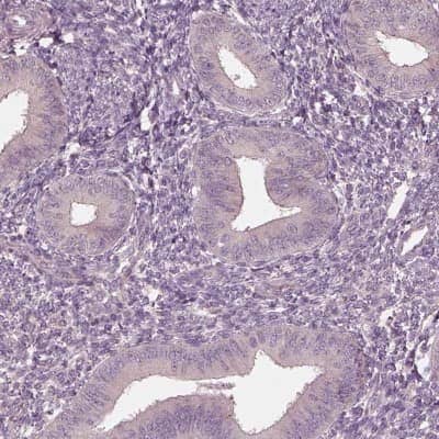 Immunohistochemistry-Paraffin: VWA5B1 Antibody [NBP2-57637] - Staining of human endometrium shows low expression as expected.