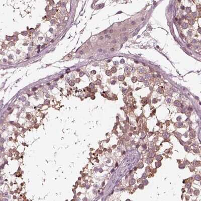 Immunohistochemistry-Paraffin: VWA5B1 Antibody [NBP2-57637] - Staining of human testis shows high expression.