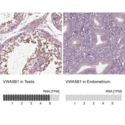 Immunohistochemistry-Paraffin: VWA5B1 Antibody [NBP2-57637] - Staining in human testis and endometrium tissues using anti-VWA5B1 antibody. Corresponding VWA5B1 RNA-seq data are presented for the same tissues.