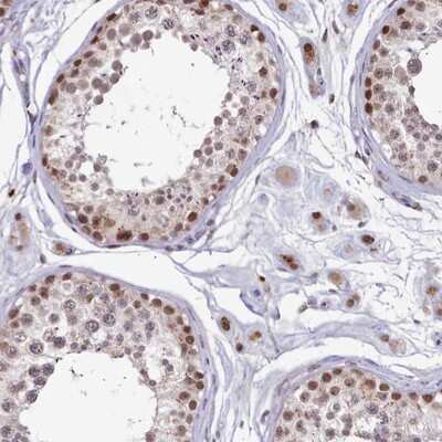 Immunohistochemistry-Paraffin: VWA9 Antibody [NBP1-90525] - Staining of human testis shows moderate nuclear positivity in cells in seminiferus ducts and leydig cells.