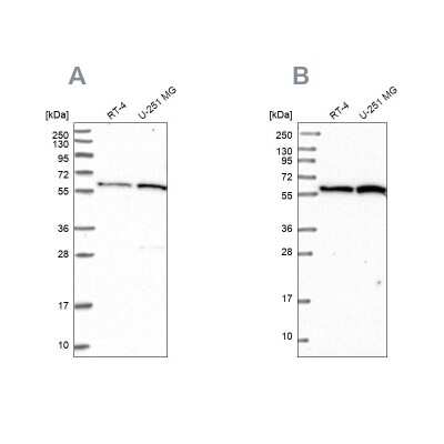 Western Blot: VWA9 Antibody [NBP1-90525] - Analysis using Anti-INTS14 antibody NBP1-90525 (A) shows similar pattern to independent antibody NBP1-90524 (B).
