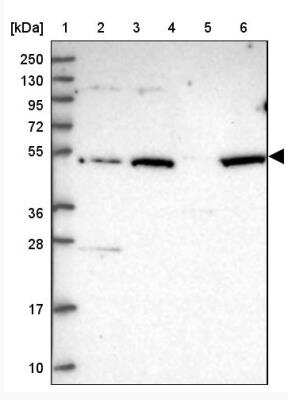 Western Blot: VWCE Antibody [NBP2-30467] - Lane 1: Marker [kDa] 250, 130, 95, 72, 55, 36, 28, 17, 10Lane 2: Human cell line RT-4Lane 3: Human cell line U-251 MGLane 4: Human plasmaLane 5: Human Liver tissueLane 6: Human Tonsil tissue