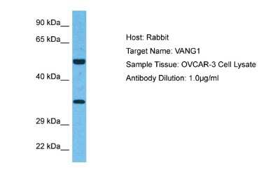 Western Blot: Vang-like Protein 1/VANGL1 Antibody [NBP2-88565] - Host: Rabbit. Target Name: VANG1. Sample Type: OVCAR-3 Whole Cell lysates. Antibody Dilution: 1.0ug/ml