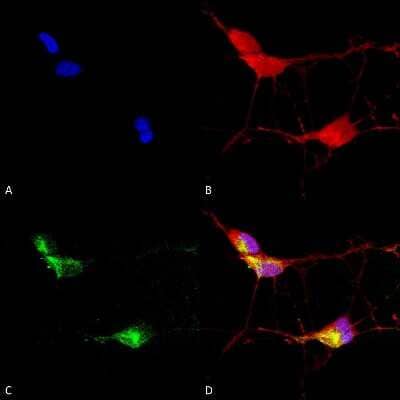 Immunocytochemistry/Immunofluorescence: Vanilloid R-like 3/TRPV3 Antibody (S15/4) [NBP2-12909] - Immunocytochemistry/Immunofluorescence analysis using Mouse Anti-TrpV3 Monoclonal Antibody, Clone N15/4 (NBP2-12909). Tissue: Neuroblastoma cells (SH-SY5Y). Species: Human. Fixation: 4% PFA for 15 min. Primary Antibody: Mouse Anti-TrpV3 Monoclonal Antibody (NBP2-12909) at 1:100 for overnight at 4C with slow rocking. Secondary Antibody: AlexaFluor 488 at 1:1000 for 1 hour at RT. Counterstain: Phalloidin-iFluor 647 (red) F-Actin stain; Hoechst (blue) nuclear stain at 1:800, 1.6mM for 20 min at RT. (A) Hoechst (blue) nuclear stain. (B) Phalloidin-iFluor 647 (red) F-Actin stain. (C) TrpV3 Antibody (D) Composite.