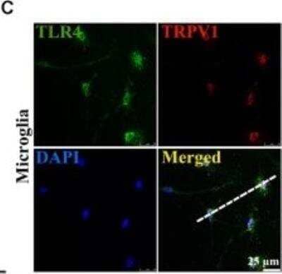 Immunocytochemistry/Immunofluorescence: Vanilloid R1/TRPV1 Antibody [NB100-98886] - Vanilloid R1/TRPV1 and toll-like receptor 4 (TLR4) mutually inhibited the transforming growth factor-beta1 (TGF-beta1) signaling in activated microglia. Photomicrograph immunocytochemistry indicated different co-expression of Vanilloid R1/TRPV1 (visualized in red Cy3), TLR4 (visualized in green DyLight 488), and cell nuclei (visualized in dark blue DAPI) in activated microglia. Image collected and cropped by CiteAb from the following publication (www.frontiersin.org/article/10.3389/fncel.2019.00442/full) licensed under a CC-BY license.