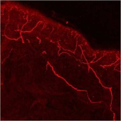 Immunohistochemistry-Frozen: Vanilloid R1/TRPV1 Antibody [NB120-3487] - Frozen human skin tissue sections were fixed with paraformaldehyde and stained. Vanilloid Receptor 1 staining is shown in red. Data courtesy of the Innovators Program.