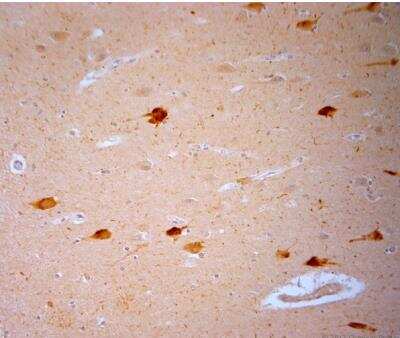 Immunohistochemistry-Paraffin: Vanilloid R1/TRPV1 Antibody [NB100-98886] - Human hippocampus. HIER: Tris-EDTA, pH 9 for 20 min. Blocking: 0.2% LFDM in TBST filtered thru 0.2 um.