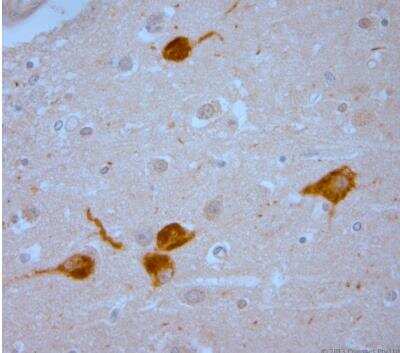 Immunohistochemistry-Paraffin: Vanilloid R1/TRPV1 Antibody [NB100-98886] - Human hippocampus. HIER: Tris-EDTA, pH 9 for 20 min. Blocking: 0.2% LFDM in TBST filtered thru 0.2 um