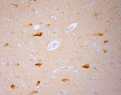 Immunohistochemistry-Paraffin: Vanilloid R1/TRPV1 Antibody [NB100-98886] - Human hippocampus. HIER: Tris-EDTA, pH 9 for 20 min. Blocking: 0.2% LFDM in TBST filtered thru 0.2 um