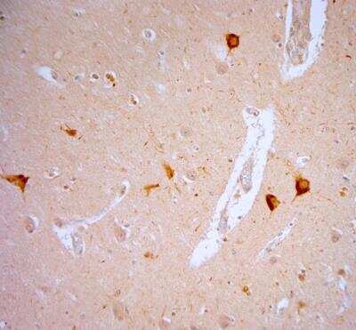 Immunohistochemistry-Paraffin: Vanilloid R1/TRPV1 Antibody [NB100-98886] - Human hippocampus. HIER: Tris-EDTA, pH 9 for 20 min. Blocking: 0.2% LFDM in TBST filtered thru 0.2 um