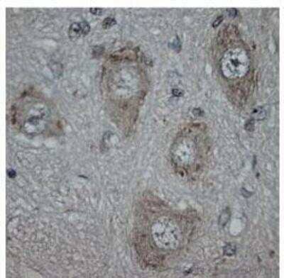 Immunohistochemistry-Paraffin: Vanilloid R1/TRPV1 Antibody [NB100-98897] - IHC on rat spinal cord (paraffin section) using Rabbit antibody to 3d cytoplasmic loop TRPV1 (VR1, capsaicin receptor, vanilloid receptor 1): whole serum (NB100-98897) at 1: 300 dilution incubated overnight at 4C.