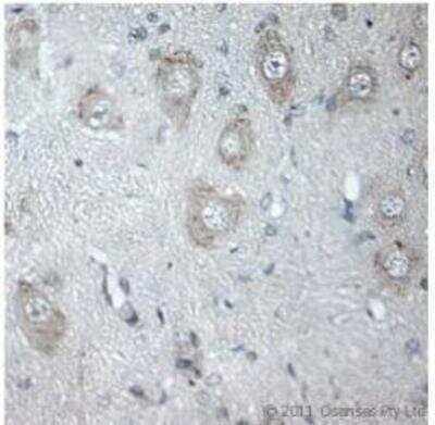 Immunohistochemistry-Paraffin: Vanilloid R1/TRPV1 Antibody [NB100-98897] - IHC on rat spinal cord (paraffin section) using Rabbit antibody to 3d cytoplasmic loop TRPV1 (VR1, capsaicin receptor, vanilloid receptor 1): whole serum (NB100-98897) at 1: 300 dilution incubated overnight at 4C.